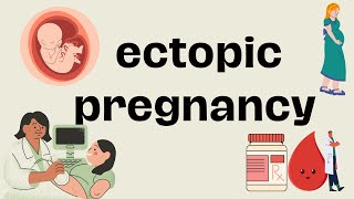 Ectopic Pregnancy Signs And Symptoms Diagnosis And Treatment