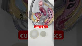 Menstrual Cups vs Menstrual Discs - quick overview #shorts