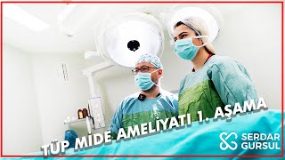 Tüp mide Ameliyatı 1. Aşama