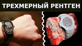 3D рентген.  Прорывная технология для медицины!