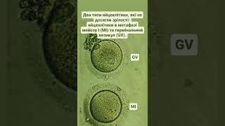 Two types of immature human oocytes: meiosis I metaphase (MI) oocytes and germinal vesicle (GV).