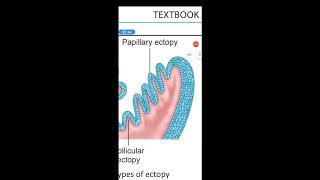 Bening  lesions of cervix