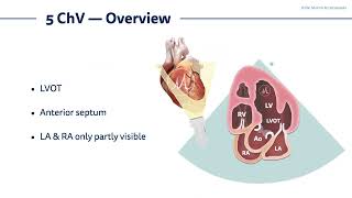 〖Echocardiography〗 5-chamber view - the LVOT