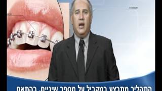 טיפול אורתודנטי - יישור שיניים