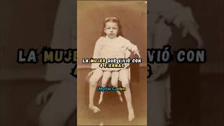 Myrtle Corbin - La mujer con 4 piernas 🦵🏻