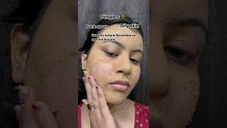 Simple remedies for pimples😳check📌 comment #skincare #hack #viralvideo #shorts #shortvideo #short