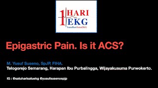 Epigastric Pain. Is it Acute Coronary Syndrome?