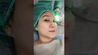 Facial paling worth it. The best facial, Vorta Beauty Clinic di PIK #laser #facial