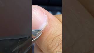 Nasty Cuticle Trim shorts nails nailart