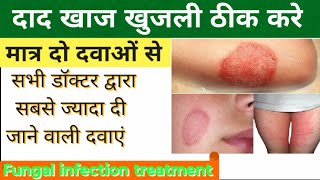 Dad Khaj Khujli की दवा | Fungal Infection Treatment | दाद की दवा | Fungal Infection Medicine | खुजली