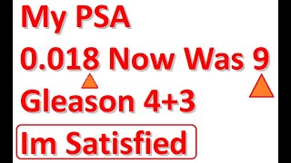 my PSA is 0 018 Now Im satisfied PSA 9 before removing by Da Vinci surgical removing Gleason 4+3