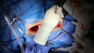 splenectomy in a dog using ligasure