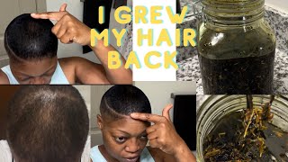 Homemade Hair oil for rapid growth