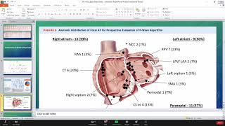 Atrial Tachycardia   Dr  John Marcos