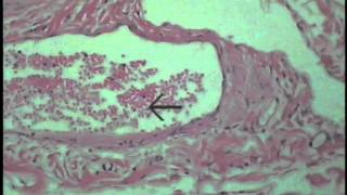 Histology of the Cardiovascular System Part 2