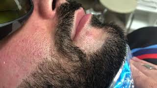 Facial hair, middle eastern man, beard shaping, laser hair removal Raleigh, NC