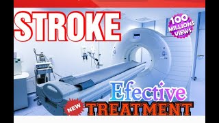 What is the treatment for stroke???