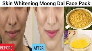 Skin Whitening Moong Dal Face Pack to get Fair, Acne Free & Wrinkle Free Skin