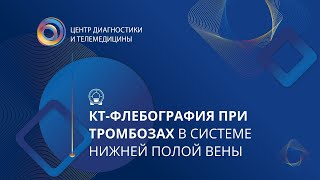 КТ-флебография при тромбозах в системе нижней полой вены