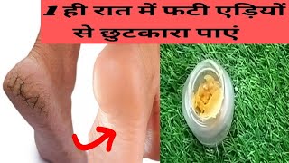 फटी हुई एड़ियों से हमेशा के लिए पाएं छुटकारा || Home Remedy for Cracked Heels - YouTube