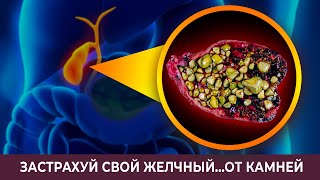 Избавь свой желчный от камней! Как лечить желчнокаменную болезнь?