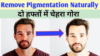 Pigmentation treatment on face | Pigmentation kaise hataye