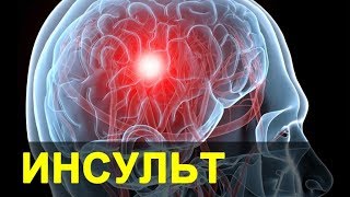 ИНСУЛЬТ ЛЕЧЕНИЕ ПО БОЛОТОВУ