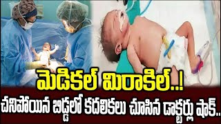 విశాఖ కేజీహెచ్ లో అద్భుతం    Medical Miracle In Vizag KGH Hospita   Sri Media News SMT