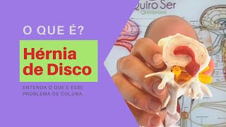 Hérnia de disco - O que é?