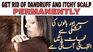 How to Get Rid of Dandruff and Itchy Scalp Easy and Fast | Hair Fall from Dandruff-Healthcare Remedy