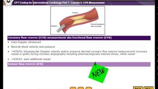 HCGTV: Haugen Academy Demo - Interventional Cardiology - CFR Measurement