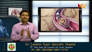 Sri Lakshmi Super Speciality Hospital presents  HELLO DOCTOR  Dr. Manjunath  Urologist