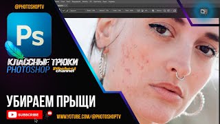 Как быстро убрать прыщи и угри в Фотошопе | Photoshop TV