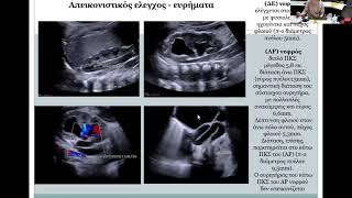 Α. Πολαναγνωστάκη - Ενδιαφέροντα περιστατικά παθήσεων ουροποιητικού στα παιδιά