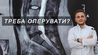 ЧИ ТРЕБА ОПЕРУВАТИ КИЛУ?/розбір клінічного випадку | Невролог Вадим Драгулов