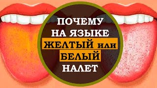 Почему на языке белый  или желтый налёт. Факты про тело человека