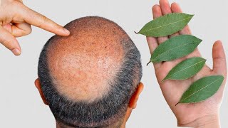 MINHA CARECA ESTÁ CHEIA DE CABELO NOVO - Descubra essa receita poderosa!