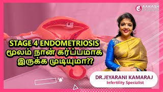 stage 4 endometriosis  மூலம் நான் கர்ப்பமாக இருக்க முடியுமா?