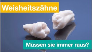 Weisheitszähne - wann sie heraus müssen?