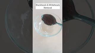 Blackheads & Whiteheads Removal l Remove Blackheads At Home #shorts #ytshorts #youtubeshorts