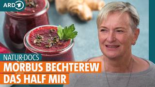 Morbus Bechterew: Mit Fasten, Kurkuma und Physiotherapie Symptome lindern I ARD Gesund