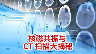 10.13 医疗黑科技：核磁共振与 CT 扫描大揭秘