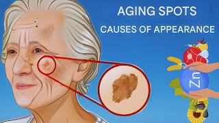 5 Real Causes of Aging Spots You Should Know (Compilation)