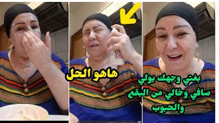 وصفة المعجزة غير رشة منو يولي وجهك بحال البلار ودعي البقع الكلف الحبوب استعمليه لوجهك ويديك وردي عل