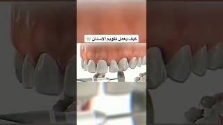 $ #معلومات #اكسبلور #dentist #طبيب #explore #تقويم_اسنان