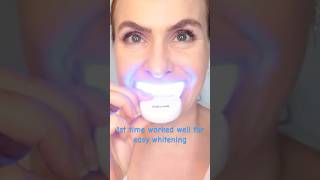 Easy Instant Whitening Kit ✨ Amazon Find