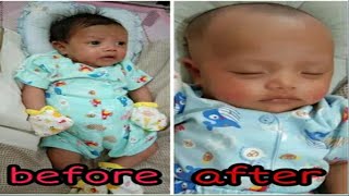 tutorial mencukur bayi baru lahir sendiri di rumah  | Cara cukur bayi baru lahir