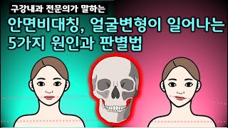 안면비대칭, 얼굴변형, 무턱, 교합변화의 5가지 원인과 실질적으로 판별하는 방법