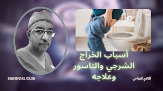 أسباب الخراج الشرجي والناسور وعلاجة