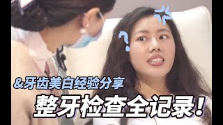 牙齒美白經驗分享｜求助！到底要不要戴隱形牙套（含合作內容）